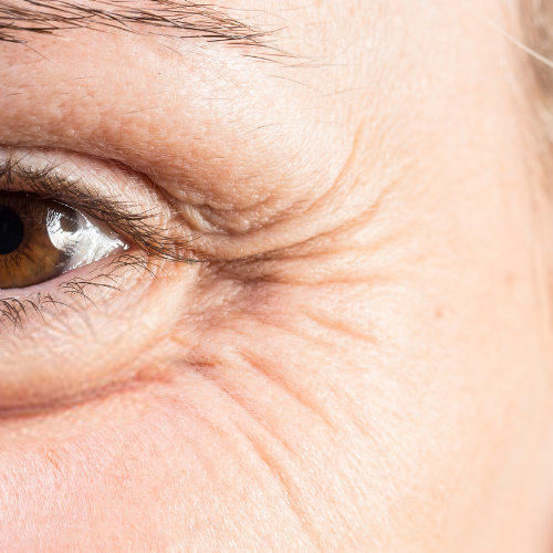 <p><strong>Fine Lines & Wrinkles Reduction</strong></p>